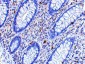 KAI1 Antibody